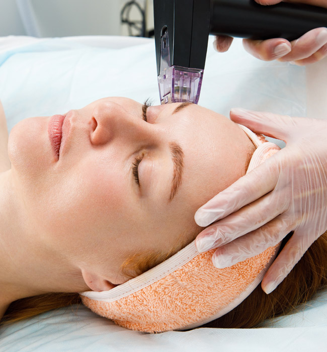 Morpheus8 RF Microneedling Treatment Indianapolis